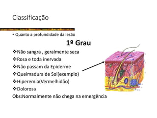 Classificação
• Quanto a profundidade da lesão
1º Grau
Não sangra , geralmente seca
Rosa e toda inervada
Não passam da Epiderme
Queimadura de Sol(exemplo)
Hiperemia(Vermelhidão)
Dolorosa
Obs:Normalmente não chega na emergência
 