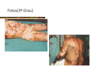 Fotos(3º Grau)
 