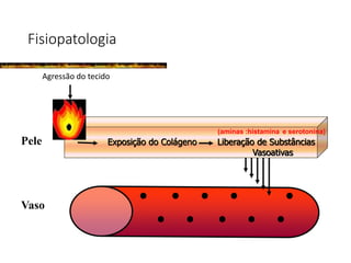 Fisiopatologia
Agressão do tecido
Vaso
Pele Exposição do Colágeno Liberação de Substâncias
Vasoativas
(aminas :histamina e serotonina)
 