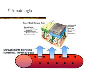Fisiopatologia
Extravasamento de Plasma
(Eletrólitos , Proteínas e etc)
 