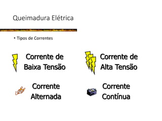 Queimadura Elétrica
• Tipos de Correntes
Corrente de
Baixa Tensão
Corrente de
Alta Tensão
Corrente
Alternada
Corrente
Contínua
 