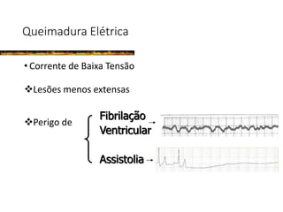 Queimadura Elétrica
• Corrente de Baixa Tensão
Lesões menos extensas
Perigo de
Fibrilação
Ventricular
Assistolia
 