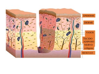 EPIDERME
DERME
VASOS
TECIDO
ADIPOSO
NERVO
colágeno
MUSCULO
 