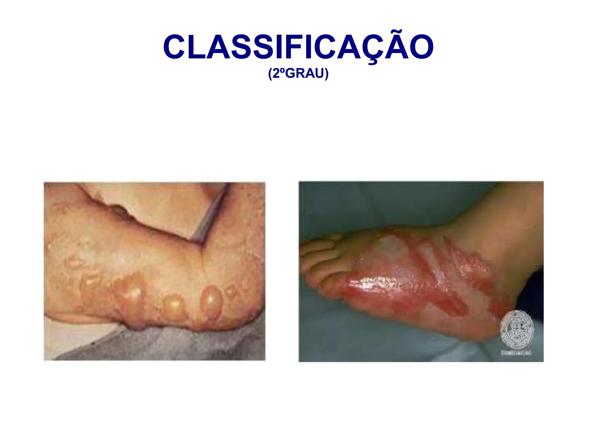 CLASSIFICAÇÃO
(2ºGRAU)
 