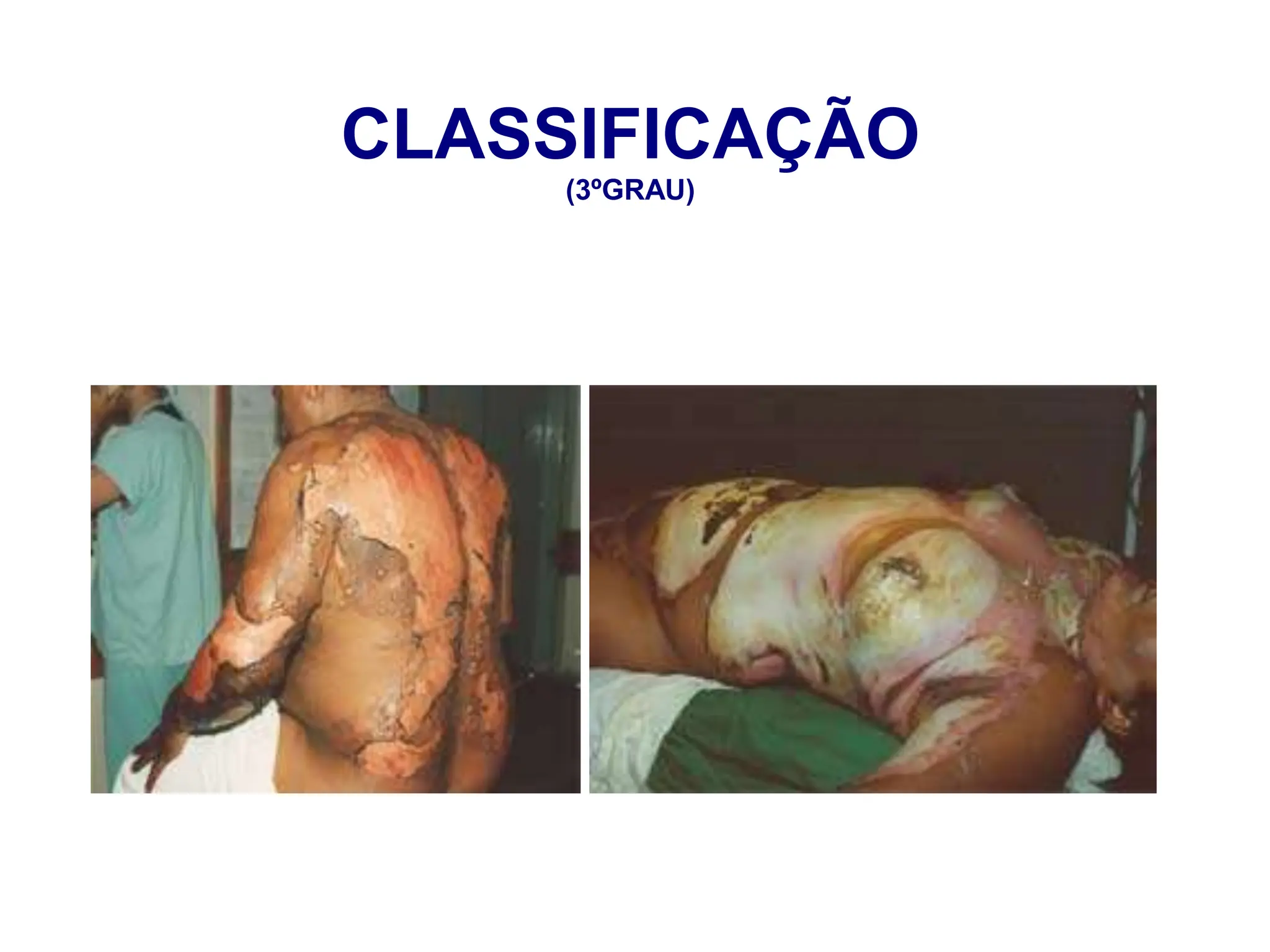CLASSIFICAÇÃO
(3ºGRAU)
 
