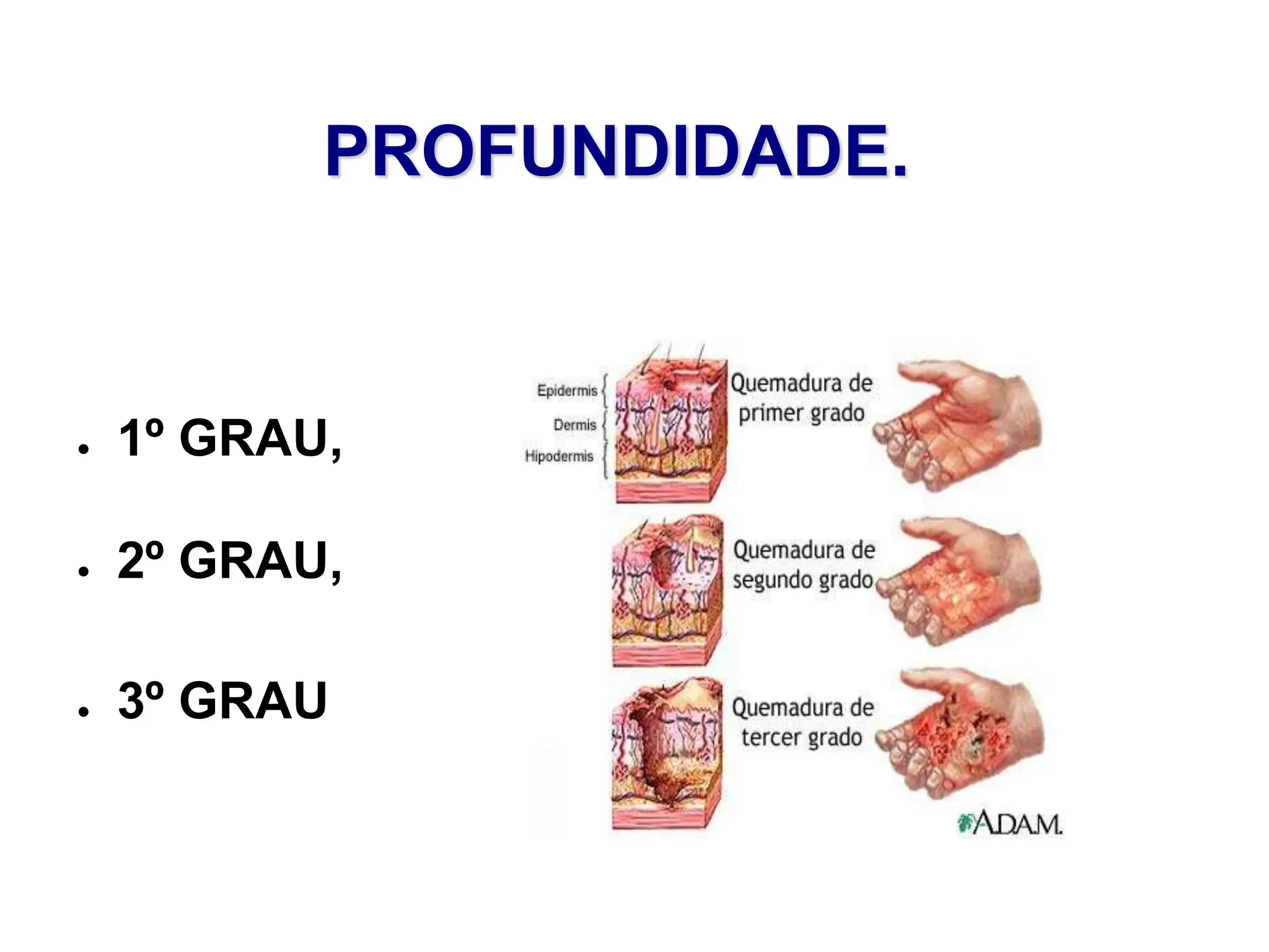 PROFUNDIDADE.
● 1º GRAU,
● 2º GRAU,
● 3º GRAU
 