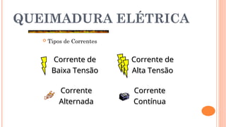 QUEIMADURA ELÉTRICA
 Tipos de Correntes
Corrente de
Corrente de
Baixa Tensão
Baixa Tensão
Corrente de
Corrente de
Alta Tensão
Alta Tensão
Corrente
Corrente
Alternada
Alternada
Corrente
Corrente
Contínua
Contínua
 