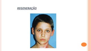 REGENERAÇÃO
 