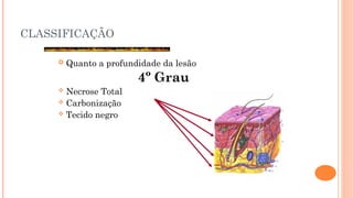 CLASSIFICAÇÃO
 Quanto a profundidade da lesão
4º Grau
 Necrose Total
 Carbonização
 Tecido negro
 