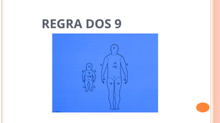 REGRA DOS 9
 