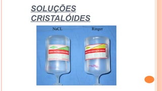 SOLUÇÕES
CRISTALÓIDES
NaCL Ringer
 