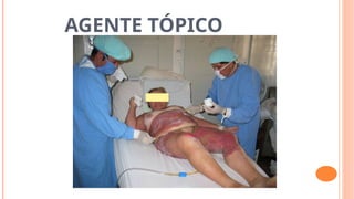 AGENTE TÓPICO
 