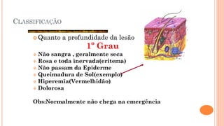 CLASSIFICAÇÃO
 Quanto a profundidade da lesão
1º Grau
 Não sangra , geralmente seca
 Rosa e toda inervada(eritema)
 Não passam da Epiderme
 Queimadura de Sol(exemplo)
 Hiperemia(Vermelhidão)
 Dolorosa
Obs:Normalmente não chega na emergência
 