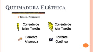 QUEIMADURA ELÉTRICA
 Tipos de Correntes
Corrente de
Baixa Tensão
Corrente de
Alta Tensão
Corrente
Alternada
Corrente
Contínua
 