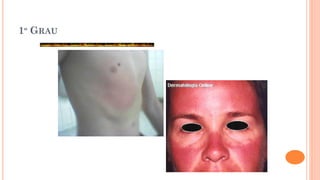 1º GRAU
 