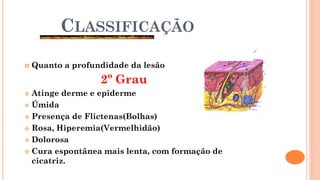 CLASSIFICAÇÃO
 Quanto a profundidade da lesão
2º Grau
 Atinge derme e epiderme
 Úmida
 Presença de Flictenas(Bolhas)
 Rosa, Hiperemia(Vermelhidão)
 Dolorosa
 Cura espontânea mais lenta, com formação de
cicatriz.
 