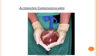 ALTERAÇÕES CARDIOVASCULARES
 
