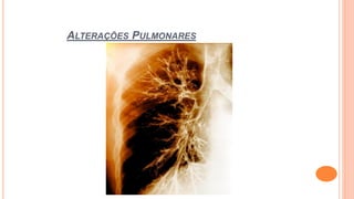ALTERAÇÕES PULMONARES
 
