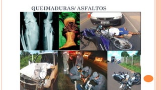 QUEIMADURAS/ ASFALTOS
 