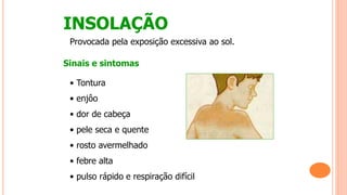 INSOLAÇÃO
Provocada pela exposição excessiva ao sol.
Sinais e sintomas
• Tontura
• enjôo
• dor de cabeça
• pele seca e quente
• rosto avermelhado
• febre alta
• pulso rápido e respiração difícil
 