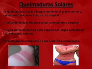 Queimaduras Solares
As queimaduras solares são geralmente do 1º grau e, por isso,
podem ser tratadas sem recurso ao hospital.
 Aplicação de água fria para baixar a temperatura corporal;
 A pele perde líquidos ao estar exposta por longos períodos ao
sol. Hidratação cutânea.
 A aplicação de cremes alivia a dor e acelera a recuperação.

 