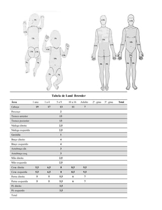 Tabela de Lund Browder
Área 1 ano 1 a 4 5 a 9 10 a 16 Adulto 2°. grau 3°. grau Total
Cabeça 19 17 13 11 7
Pescoço 2
Tronco anterior 13
Tronco posterior 13
Nádega direita 2,5
Nádega esquerda 2,5
Genitália 1
Braço direito 4
Braço esquerdo 4
Antebraço dir. 3
Antebraço esq. 3
Mão direita 2,5
Mão esquerda 2,5
Coxa direita 5,5 6,5 8 8,5 9,5
Coxa esquerda 5,5 6,5 8 8,5 9,5
Perna direita 5 5 5,5 6 7
Perna esquerda 5 5 5,5 6 7
Pé direito 3,5
Pé esquerdo 3,5
Total
 