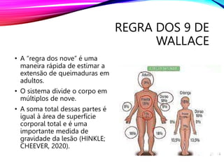 REGRA DOS 9 DE
WALLACE
• A “regra dos nove” é uma
maneira rápida de estimar a
extensão de queimaduras em
adultos.
• O sistema divide o corpo em
múltiplos de nove.
• A soma total dessas partes é
igual à área de superfície
corporal total e é uma
importante medida de
gravidade da lesão (HINKLE;
CHEEVER, 2020).
 