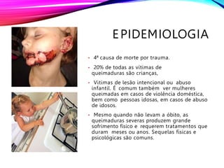 EPIDEMIOLOGIA
• 4ª causa de morte por trauma.
• 20% de todas as vítimas de
queimaduras são crianças,
• Vitimas de lesão intencional ou abuso
infantil. É comum também ver mulheres
queimadas em casos de violência doméstica,
bem como pessoas idosas, em casos de abuso
de idosos.
• Mesmo quando não levam a óbito, as
queimaduras severas produzem grande
sofrimento físico e requerem tratamentos que
duram meses ou anos. Sequelas físicas e
psicológicas são comuns.
 