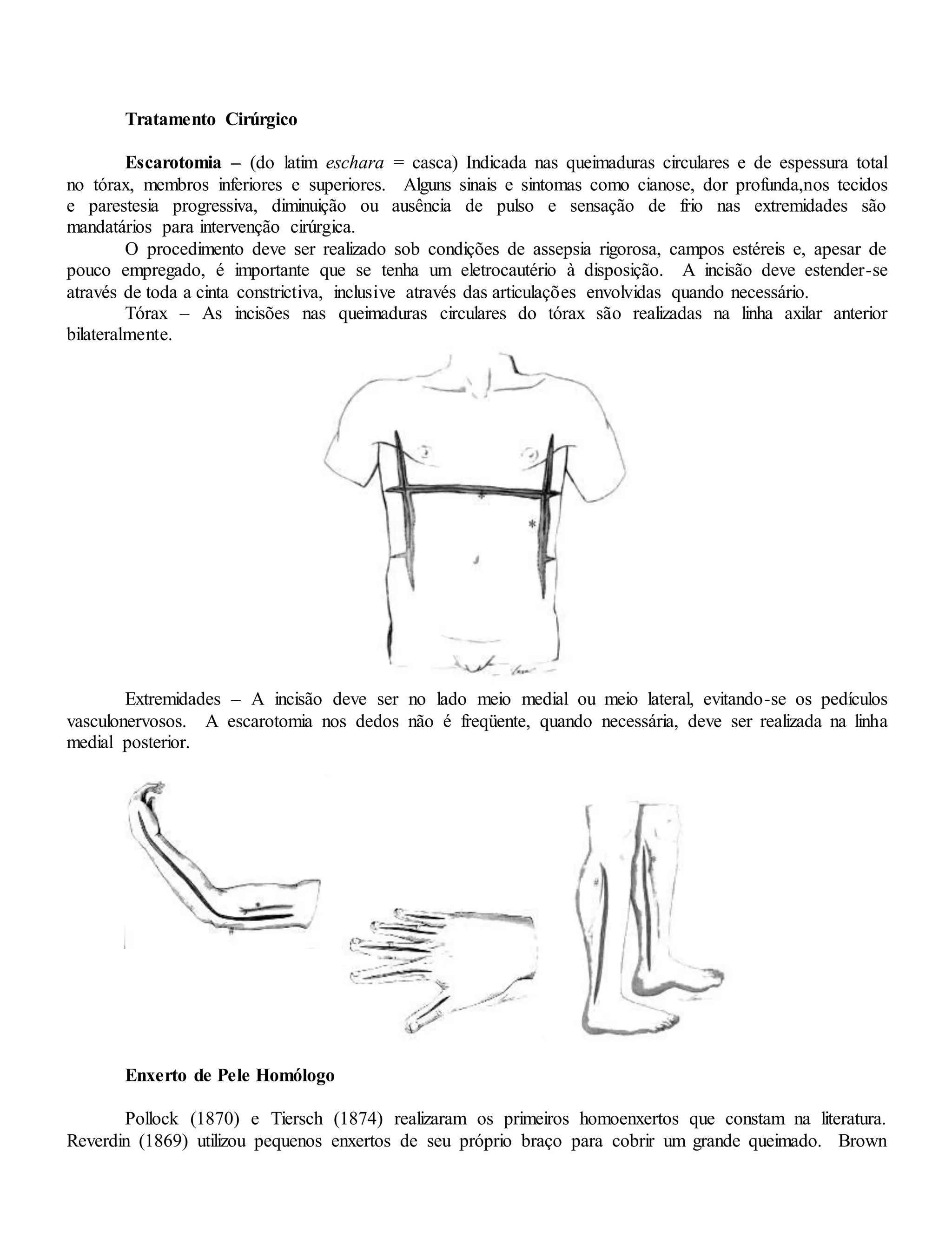 Tratamento Cirúrgico
Escarotomia – (do latim eschara = casca) Indicada nas queimaduras circulares e de espessura total
no tórax, membros inferiores e superiores. Alguns sinais e sintomas como cianose, dor profunda,nos tecidos
e parestesia progressiva, diminuição ou ausência de pulso e sensação de frio nas extremidades são
mandatários para intervenção cirúrgica.
O procedimento deve ser realizado sob condições de assepsia rigorosa, campos estéreis e, apesar de
pouco empregado, é importante que se tenha um eletrocautério à disposição. A incisão deve estender-se
através de toda a cinta constrictiva, inclusive através das articulações envolvidas quando necessário.
Tórax – As incisões nas queimaduras circulares do tórax são realizadas na linha axilar anterior
bilateralmente.
Extremidades – A incisão deve ser no lado meio medial ou meio lateral, evitando-se os pedículos
vasculonervosos. A escarotomia nos dedos não é freqüente, quando necessária, deve ser realizada na linha
medial posterior.
Enxerto de Pele Homólogo
Pollock (1870) e Tiersch (1874) realizaram os primeiros homoenxertos que constam na literatura.
Reverdin (1869) utilizou pequenos enxertos de seu próprio braço para cobrir um grande queimado. Brown
 
