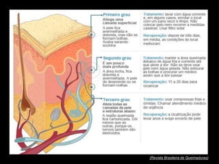(Revista Brasileira de Queimaduras) 
 