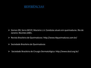 REFERÊNCIAS 
 Gomes DR, Serra MCVF, Macieira L Jr. Condutas atuais em queimaduras. Rio de 
Janeiro: Revinter;2001. 
 Revista Brasileira de Queimaduras: http://www.rbqueimaduras.com.br/ 
 Sociedade Brasileira de Queimaduras 
 Sociedade Brasileira de Cirurgia Dermatológica: http://www.sbcd.org.br/ 
