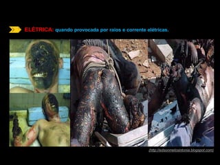 ELÉTRICA: quando provocada por raios e corrente elétricas. 
(http://edsonmelosintonia.blogspot.com) 
 