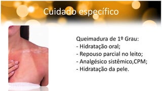 Cuidado específico 
Queimadura de 1º Grau: 
- Hidratação oral; 
- Repouso parcial no leito; 
- Analgésico sistêmico,CPM; 
- Hidratação da pele. 
 