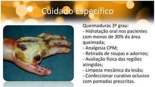 Cuidado Específico 
Queimaduras 3º grau: 
- Hidratação oral nos pacientes 
com menos de 30% da área 
queimada; 
- Analgesia CPM; 
- Retirada de roupas e adornos; 
- Avaliação física das regiões 
atingidas; 
- Limpeza mecânica da lesão; 
- Confeccionar curativo oclusivo 
com pomadas prescritas. 
