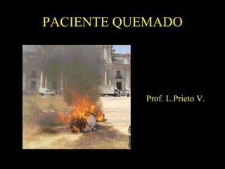 PACIENTE QUEMADO




           Prof. L.Prieto V.
 