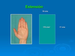 10 cms 17 cms 170 cms 2 Extensión 