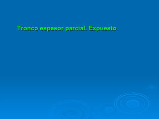 Tronco espesor parcial. Expuesto 