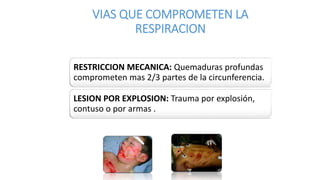 VIAS QUE COMPROMETEN LA
RESPIRACION
RESTRICCION MECANICA: Quemaduras profundas
comprometen mas 2/3 partes de la circunferencia.
LESION POR EXPLOSION: Trauma por explosión,
contuso o por armas .
 
