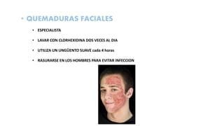 • QUEMADURAS FACIALES
• ESPECIALISTA
• LAVAR CON CLORHEXIDINA DOS VECES AL DIA
• UTILIZA UN UNGÜENTO SUAVE cada 4 horas
• RASURARSE EN LOS HOMBRES PARA EVITAR INFECCION
 