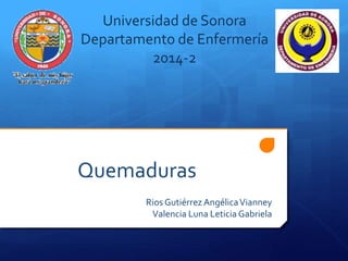 Universidad de Sonora 
Departamento de Enfermería 
2014-2 
Quemaduras 
Rios Gutiérrez Angélica Vianney 
Valencia Luna Leticia Gabriela 
 