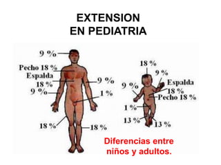 EXTENSION 
EN PEDIATRIA 
Diferencias entre 
niños y adultos. 
 