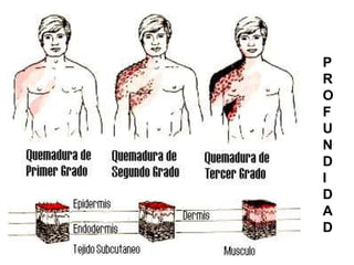 P 
R 
O 
F 
U 
N 
D 
I 
D 
A 
D 
 