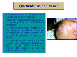 Quemaduras de Cráneo 
• Las quemaduras de 3° grado en el 
cráneo son poco frecuentes. 
• Pequeñas quemaduras craneales de 
3° grado pueden ser desbridadas e 
injertadas. 
• Si existen segmentos visibles de la 
superficie cálvaria (hueso), entonces 
se remueve la tabla externa y se 
permite la granulación previo al 
injerto. 
• La reconstrucción secundaria del 
cráneo con expansores tisulares de 
piel o colgajos, pueden restablecer el 
patrón del cabello a casi su 
apariencia normal. 
 