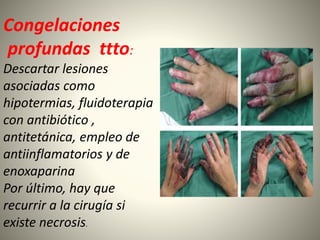 Congelaciones 
profundas ttto: 
Descartar lesiones 
asociadas como 
hipotermias, fluidoterapia 
con antibiótico , 
antitetánica, empleo de 
antiinflamatorios y de 
enoxaparina 
Por último, hay que 
recurrir a la cirugía si 
existe necrosis. 
 