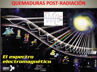 QUEMADURAS POST-RADIACIÓN 
 