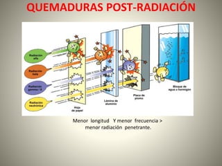 QUEMADURAS POST-RADIACIÓN 
Menor longitud Y menor frecuencia > 
menor radiación penetrante. 
 