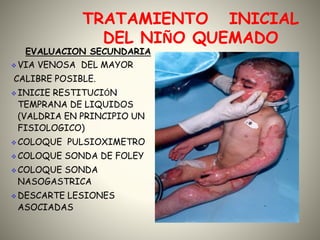 TRATAMIENTO INICIAL 
DEL NIÑO QUEMADO 
EVALUACION SECUNDARIA 
VIA VENOSA DEL MAYOR 
CALIBRE POSIBLE. 
INICIE RESTITUCIÓN 
TEMPRANA DE LIQUIDOS 
(VALDRIA EN PRINCIPIO UN 
FISIOLOGICO) 
COLOQUE PULSIOXIMETRO 
COLOQUE SONDA DE FOLEY 
COLOQUE SONDA 
NASOGASTRICA 
DESCARTE LESIONES 
ASOCIADAS 
 
