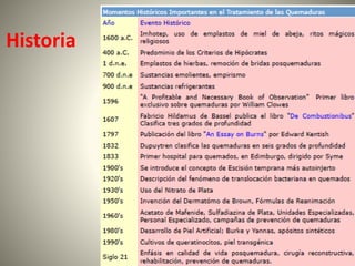 Historia 
 