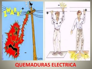 - 
+ + 
+ 
- - 
QUEMADURAS ELECTRICA 
 
