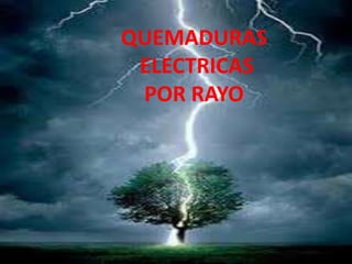 QUEMADURAS 
ELECTRICAS 
POR RAYO 
 